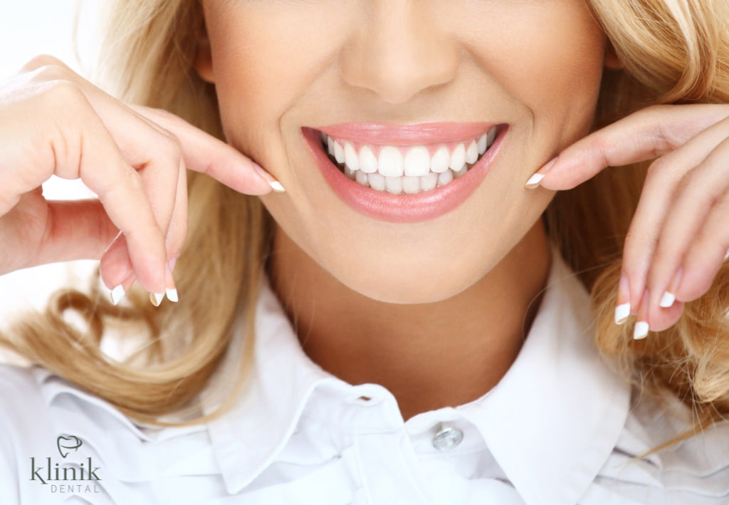 diseño sonrisa madrid