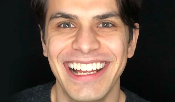 Después